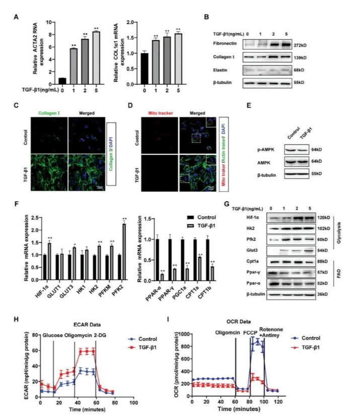 Adv. Sci.｜南医大倪春辉团队破局肺纤维化：锁定脂肪酸氧化与糖酵解 “失衡点”，挖掘关键治疗靶点(图3)