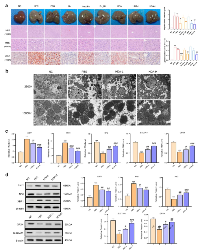 Gut Microbes (IF=12.2)｜海医二院白飞虎教授团队：解密单形拟杆菌代谢物HDA如何狙击代谢相关脂肪肝(图10)