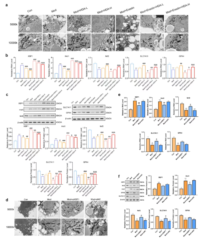 Gut Microbes (IF=12.2)｜海医二院白飞虎教授团队：解密单形拟杆菌代谢物HDA如何狙击代谢相关脂肪肝(图9)