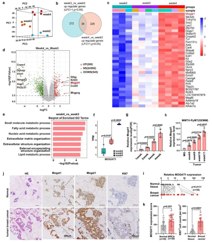 nat. commun. (IF=15.7)|西湖大学许圳杰团队:Mogat1 介导脂质代谢重编程驱动肿瘤免疫逃逸(图3) nat. commun. (IF=15.7)|西湖大学许圳杰团队:Mogat1 介导脂质代谢重编程驱动肿瘤免疫逃逸(图3)
