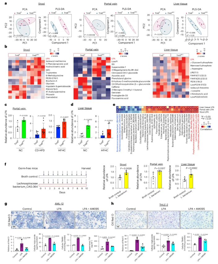 nat metab(IF=20.8) | 香港中文大学于君教授团队：肠道TM6SF2通过肠-肝轴预防代谢功能障碍相关的脂肪性肝炎(图4)