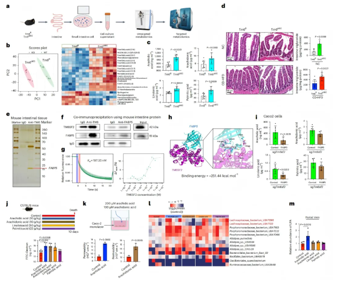 nat metab(IF=20.8) | 香港中文大学于君教授团队：肠道TM6SF2通过肠-肝轴预防代谢功能障碍相关的脂肪性肝炎(图5)