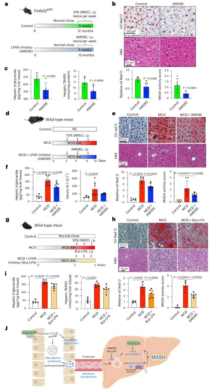 nat metab(IF=20.8) | 香港中文大学于君教授团队：肠道TM6SF2通过肠-肝轴预防代谢功能障碍相关的脂肪性肝炎(图9)