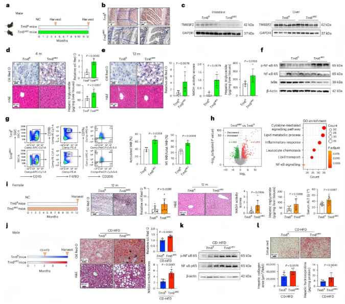 nat metab(IF=20.8) | 香港中文大学于君教授团队：肠道TM6SF2通过肠-肝轴预防代谢功能障碍相关的脂肪性肝炎(图2)