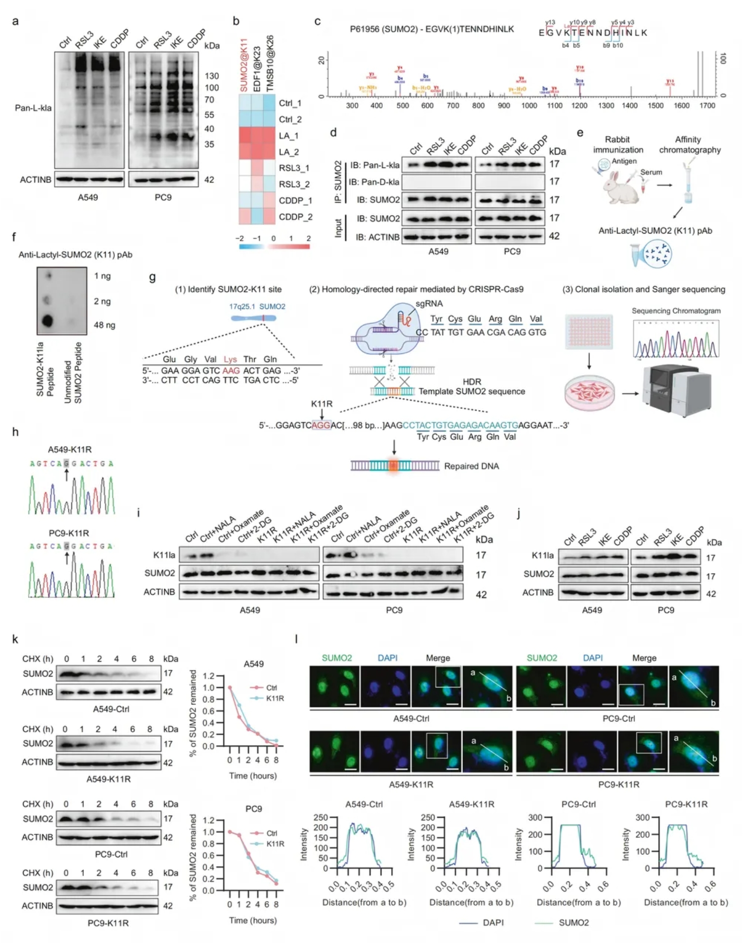 Cell Discovery(IF=12.5)|复旦附属中山医院研究团队:SUMO2乳酸化促ACSL4降解,抑制肺腺癌铁死亡(图4) Cell Discovery(IF=12.5)|复旦附属中山医院研究团队:SUMO2乳酸化促ACSL4降解,抑制肺腺癌铁死亡(图4)