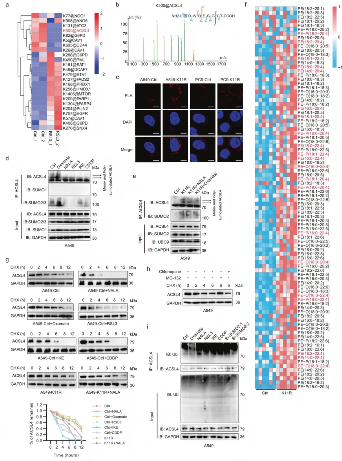 Cell Discovery(IF=12.5)|复旦附属中山医院研究团队:SUMO2乳酸化促ACSL4降解,抑制肺腺癌铁死亡(图6) Cell Discovery(IF=12.5)|复旦附属中山医院研究团队:SUMO2乳酸化促ACSL4降解,抑制肺腺癌铁死亡(图6)