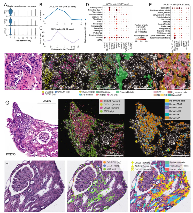 nature (IF=48.5)|重磅突破!首次绘制猪肾异种移植人体61天免疫变化“全景路线图”(图6) nature (IF=48.5)|重磅突破!首次绘制猪肾异种移植人体61天免疫变化“全景路线图”(图6)