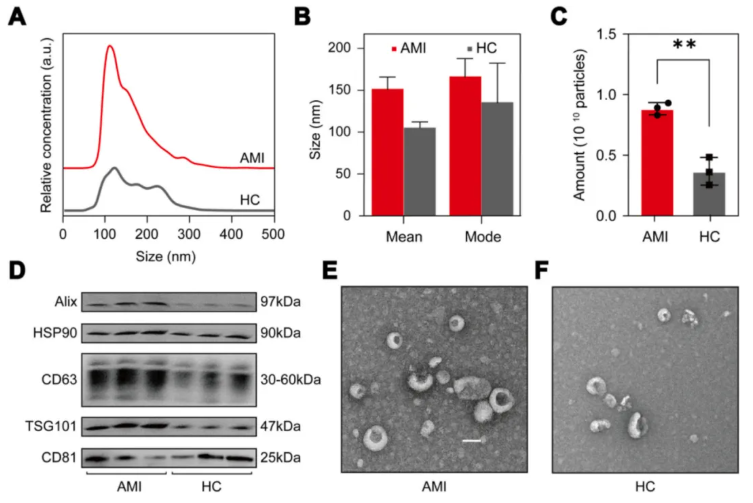 Int J Biol Macromol (IF=8.5)|长江大学第一附属医院毛旭龙团队：外泌体蛋白组学助力AMI无创标志物发现(图3)