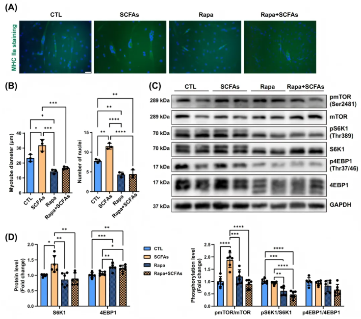 JCSM(IF=9.1)|香港中文大学研究团队：SCFAs激活mTOR通路，为肌少症治疗打开“肠道-肌肉轴”新窗口(图9)