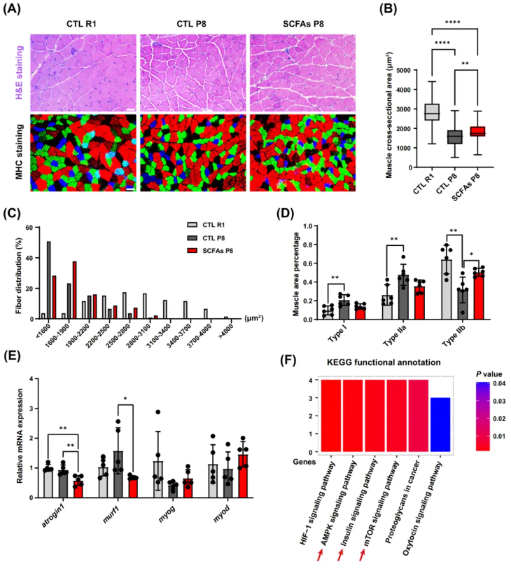 JCSM(IF=9.1)|香港中文大学研究团队：SCFAs激活mTOR通路，为肌少症治疗打开“肠道-肌肉轴”新窗口(图5)
