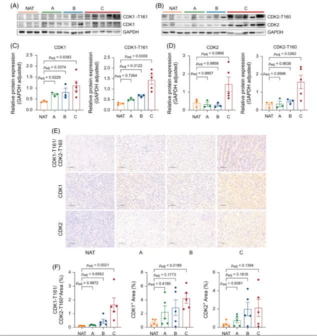 Hepatology(IF=15.8)|中国医学科学院徐平/卢实春团队通过磷酸化蛋白质组学揭示肝癌新亚型并锁定C型治疗新靶点(图7)