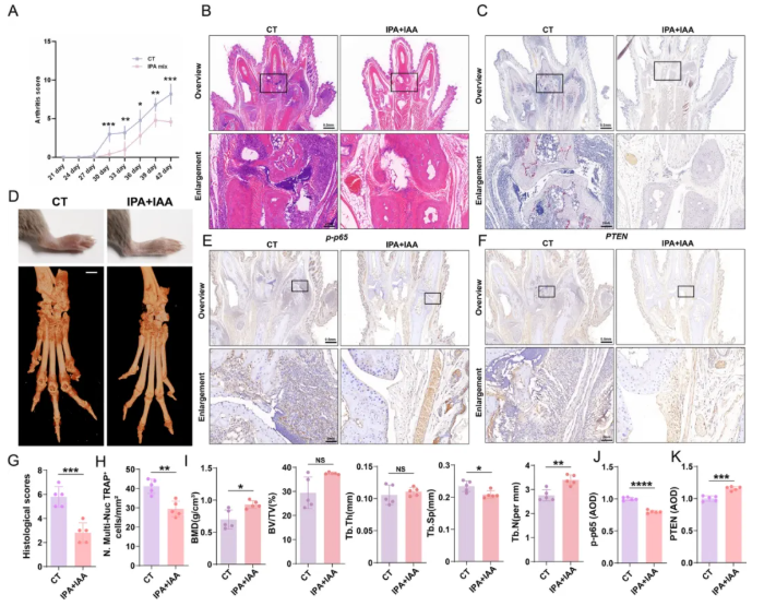 J. Nanobiotechnol.(IF=12.6)|金纳米球如何通过“肠-关节轴”，缓解类风湿关节炎进展！(图9)