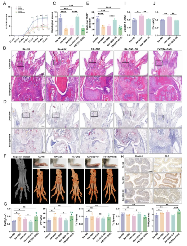 J. Nanobiotechnol.(IF=12.6)|金纳米球如何通过“肠-关节轴”，缓解类风湿关节炎进展！(图3)