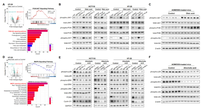 于君教授联合国内多家单位发现结直肠肿瘤的新代谢机制，提出代谢标志物的潜在应用价值(图8)