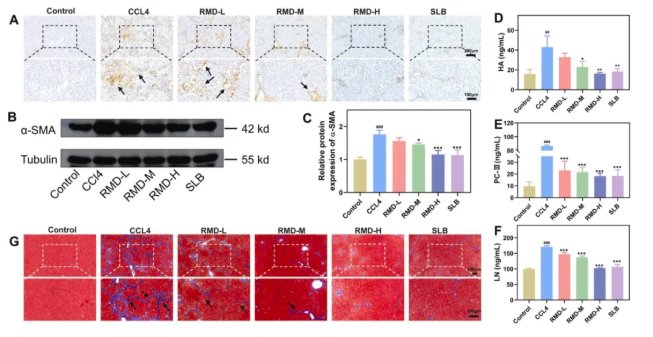J Ethnopharmacol.|陕西中医药大学史晓燕团队发现：肉牡丹汤可通过抑制糖酵解，阻断肝纤维化进程(图5)