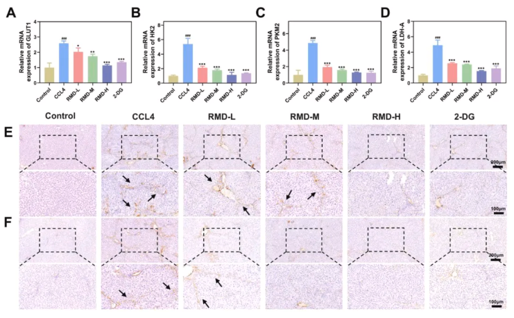 J Ethnopharmacol.|陕西中医药大学史晓燕团队发现：肉牡丹汤可通过抑制糖酵解，阻断肝纤维化进程(图9)