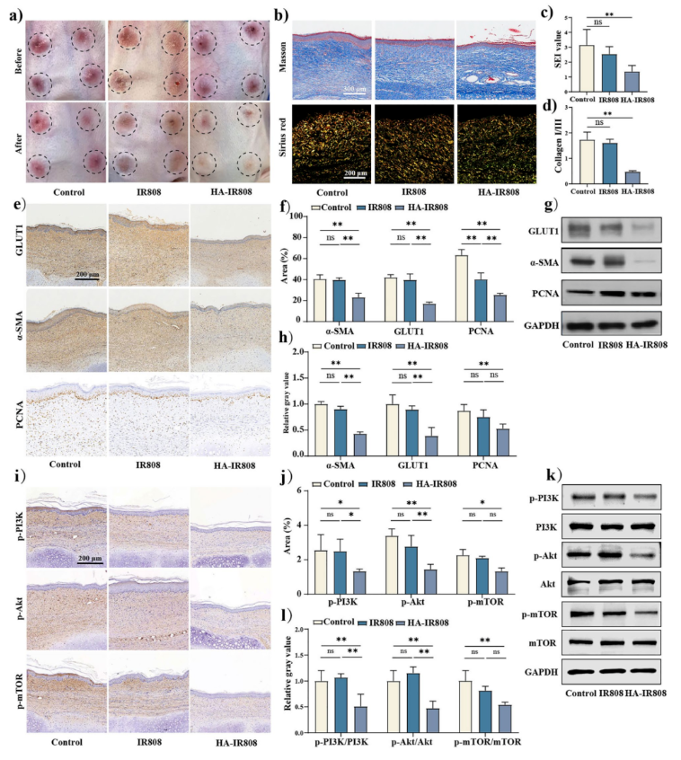 J.Nanobiotechnol. (IF=12.6)| 上海九院章一新教授团队：HA-IR808自组装纳米凝胶透皮靶向，调控糖酵解抑制瘢痕形成(图9)