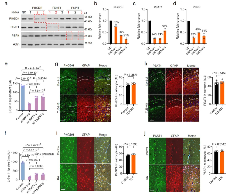 nat chem biol(IF=13.7)|中国医学科学院基础医学研究所许琪团队：抑制PSPH可降低丝氨酸水平并减少癫痫发作(图10)