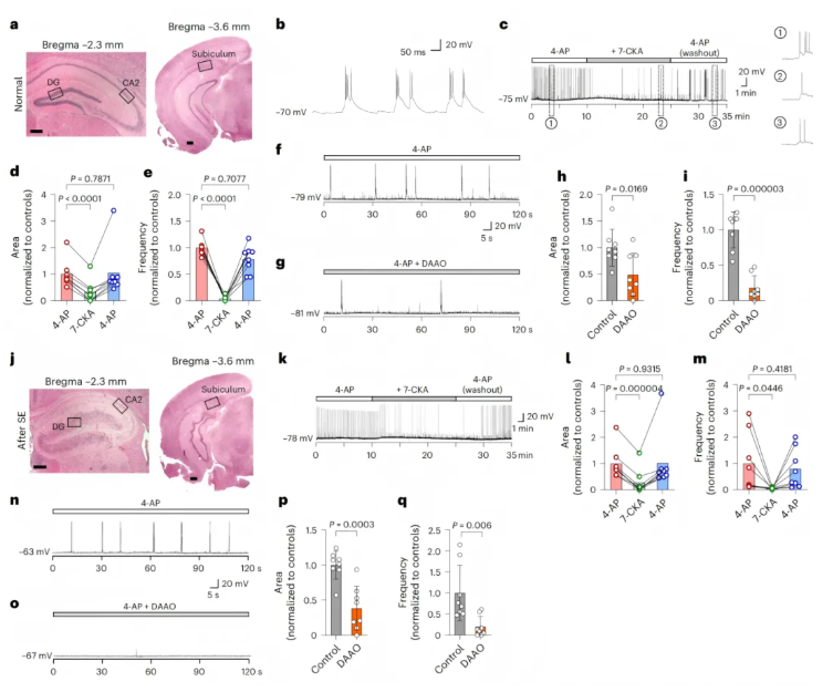 nat chem biol(IF=13.7)|中国医学科学院基础医学研究所许琪团队：抑制PSPH可降低丝氨酸水平并减少癫痫发作(图4)