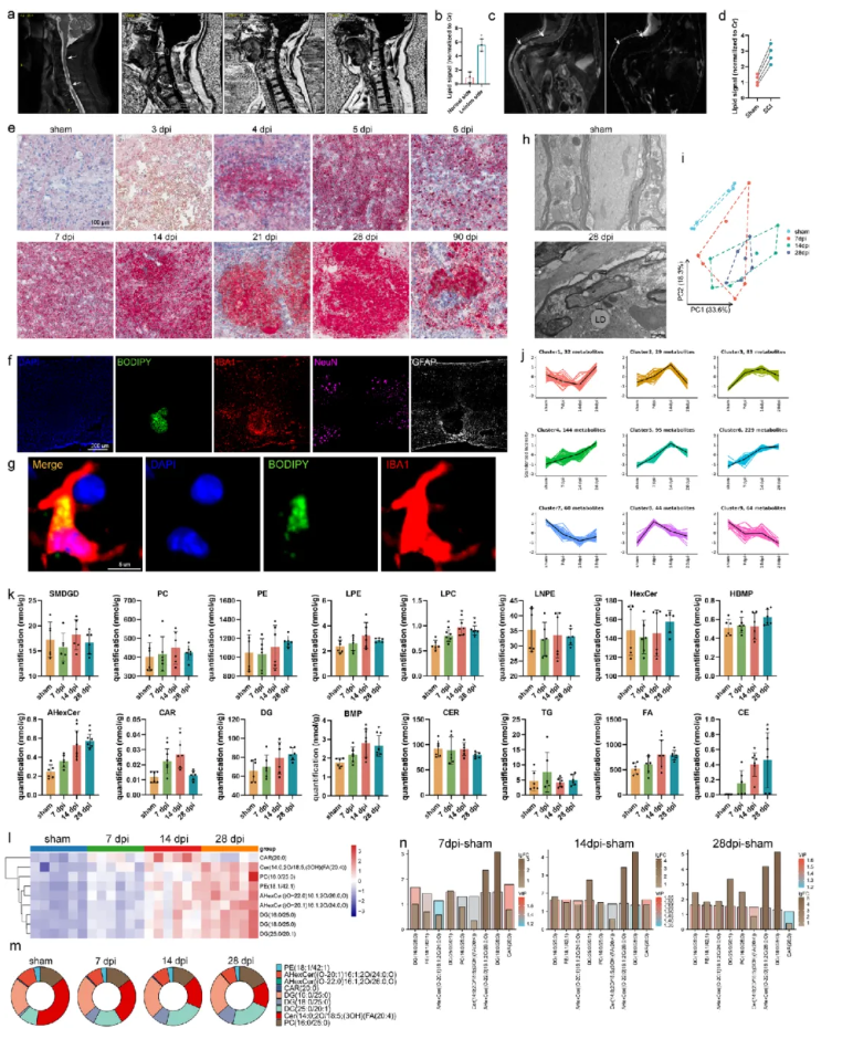 Adv.Sci.(IF=14.1)|江苏省人民医院殷国勇教授团队：调控PPARG减少小胶质细胞脂质蓄积助力脊髓损伤功能修复(图2)