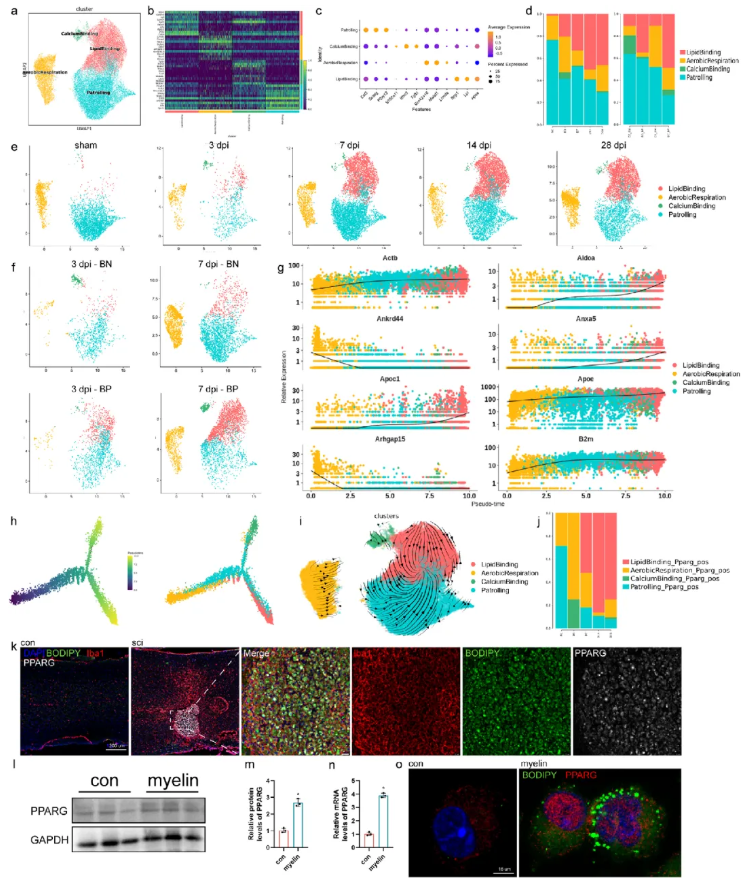 Adv.Sci.(IF=14.1)|江苏省人民医院殷国勇教授团队：调控PPARG减少小胶质细胞脂质蓄积助力脊髓损伤功能修复(图5)