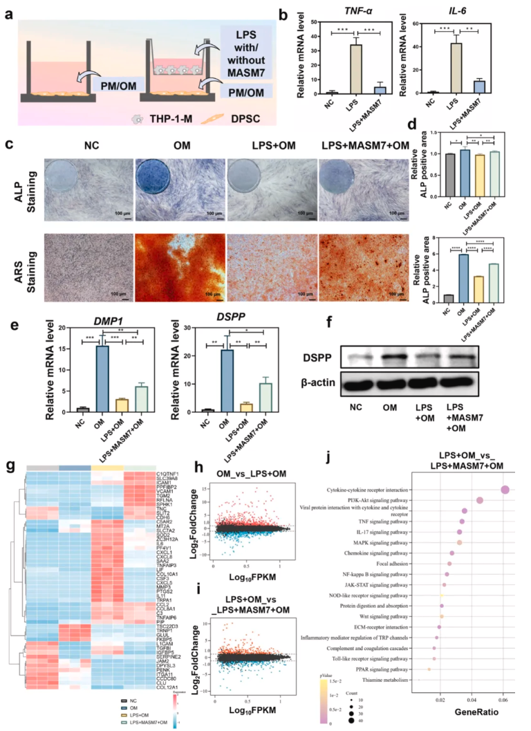 Biomaterials(IF=12.9)|北大口腔王媛媛老师团队破解牙髓修复难题，双效智能水凝胶实现“代谢重编程”促愈合(图4)