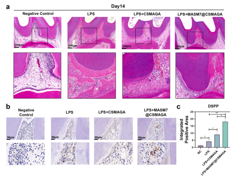 Biomaterials(IF=12.9)|北大口腔王媛媛老师团队破解牙髓修复难题，双效智能水凝胶实现“代谢重编程”促愈合(图8)