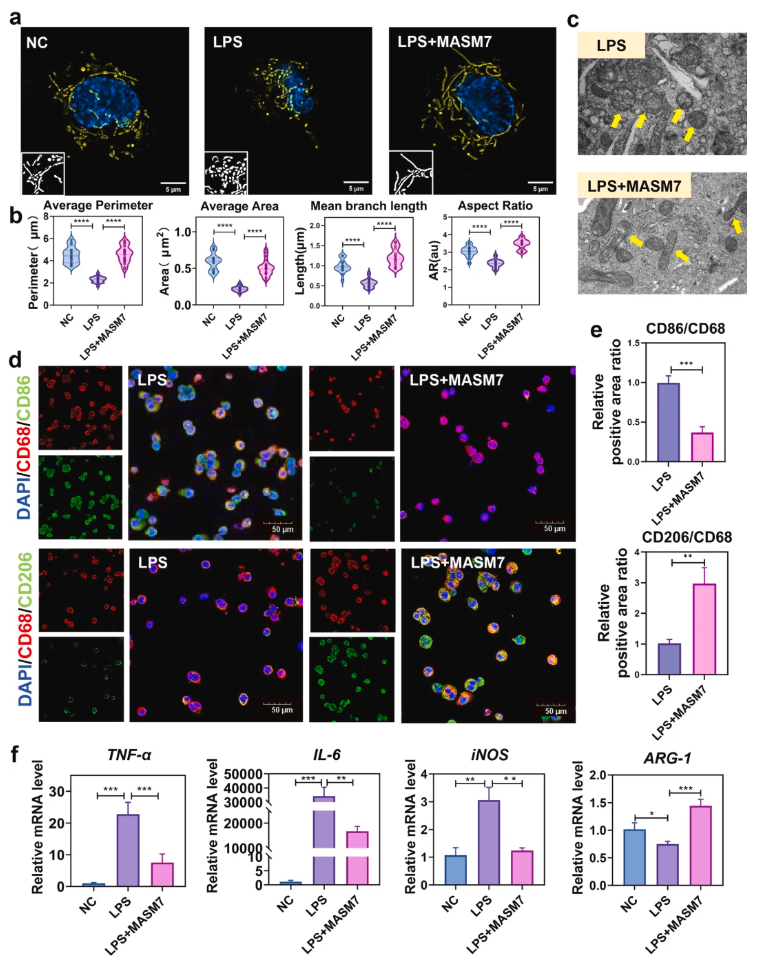 Biomaterials(IF=12.9)|北大口腔王媛媛老师团队破解牙髓修复难题，双效智能水凝胶实现“代谢重编程”促愈合(图2)