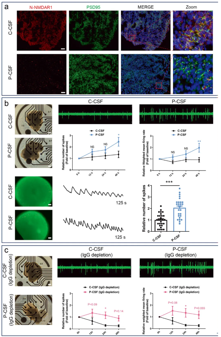 Mol. Psychiatry(IF=10.1)|南华附一蒙庆团教授团队：抗NMDAR1抗体与IL-17信号通路共塑NMDAR型脑炎病理进程(图6)