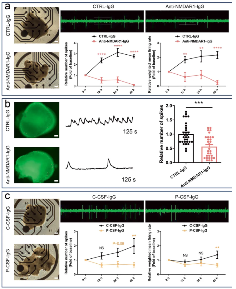 Mol. Psychiatry(IF=10.1)|南华附一蒙庆团教授团队：抗NMDAR1抗体与IL-17信号通路共塑NMDAR型脑炎病理进程(图5)