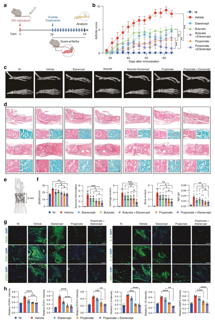 Bone Research(IF=15)|南方科技大学梁超团队：肠道微生物代谢物靶向HDAC3-FOXK1-干扰素轴，改善类风湿关节炎(图7)