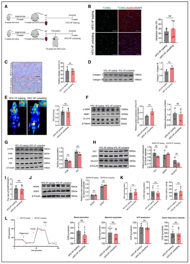 Circulation(IF=38.7)|上海儿童医学中心张浩/刘一为联合南京鼓楼医院王东进团队破解肥胖心衰LVAD疗效困局,胰岛素增敏剂助力心肌恢复!(图9) Circulation(IF=38.7)|上海儿童医学中心张浩/刘一为联合南京鼓楼医院王东进团队破解肥胖心衰LVAD疗效困局,胰岛素增敏剂助力心肌恢复!(图9)
