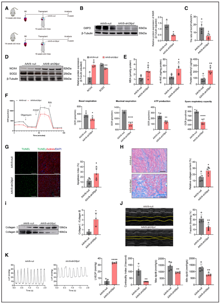 Circulation(IF=38.7)|上海儿童医学中心张浩/刘一为联合南京鼓楼医院王东进团队破解肥胖心衰LVAD疗效困局,胰岛素增敏剂助力心肌恢复!(图8) Circulation(IF=38.7)|上海儿童医学中心张浩/刘一为联合南京鼓楼医院王东进团队破解肥胖心衰LVAD疗效困局,胰岛素增敏剂助力心肌恢复!(图8)