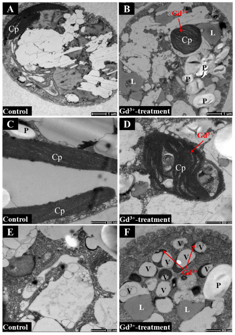 Environ.Res.(IF=7.7)|大理大学吴明灿研究团队:水中稀土元素超标,纤细裸藻揭秘钆离子多重毒性密码(图5) Environ.Res.(IF=7.7)|大理大学吴明灿研究团队:水中稀土元素超标,纤细裸藻揭秘钆离子多重毒性密码(图5)