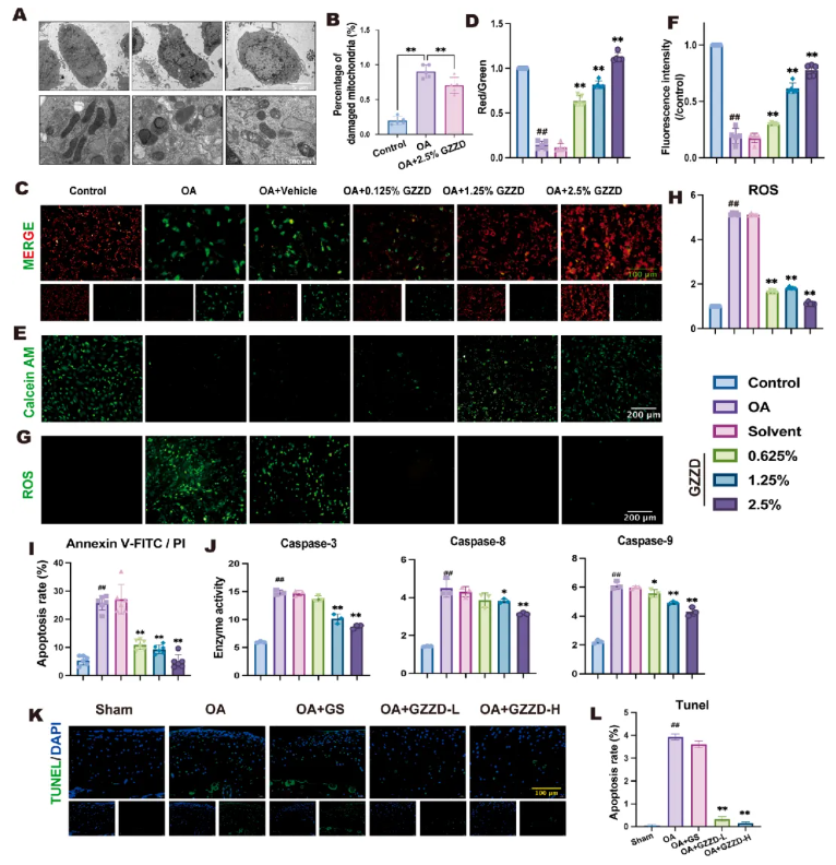 Phytomedicine(IF=8.3)|山西医科大学郑茜团队：线粒体自噬 “破局”OA！GZZD靶向FoxO1通路守护软骨细胞(图4)