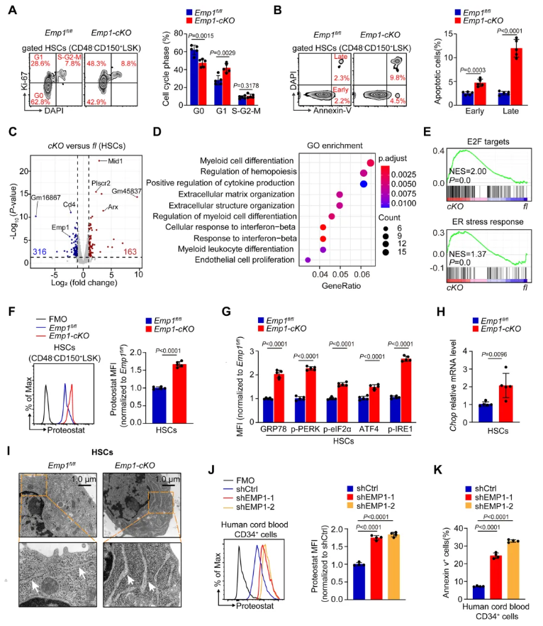 nat.commun.(IF=15.7)|重庆医科大学侯宇教授团队：EMP1调控鞘脂代谢守护造血干细胞新机制，为血液疾病干预开辟新思路(图5)