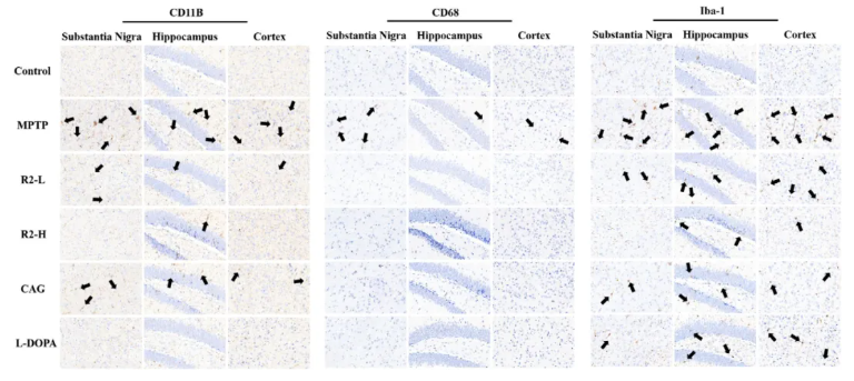 CNS Neurosci.Ther.(IF=5)|山西中医药大学研究团队:环黄芪醇R2靶向TLR4/NF-κB/TERT改善帕金森(图8) CNS Neurosci.Ther.(IF=5)|山西中医药大学研究团队:环黄芪醇R2靶向TLR4/NF-κB/TERT改善帕金森(图8)