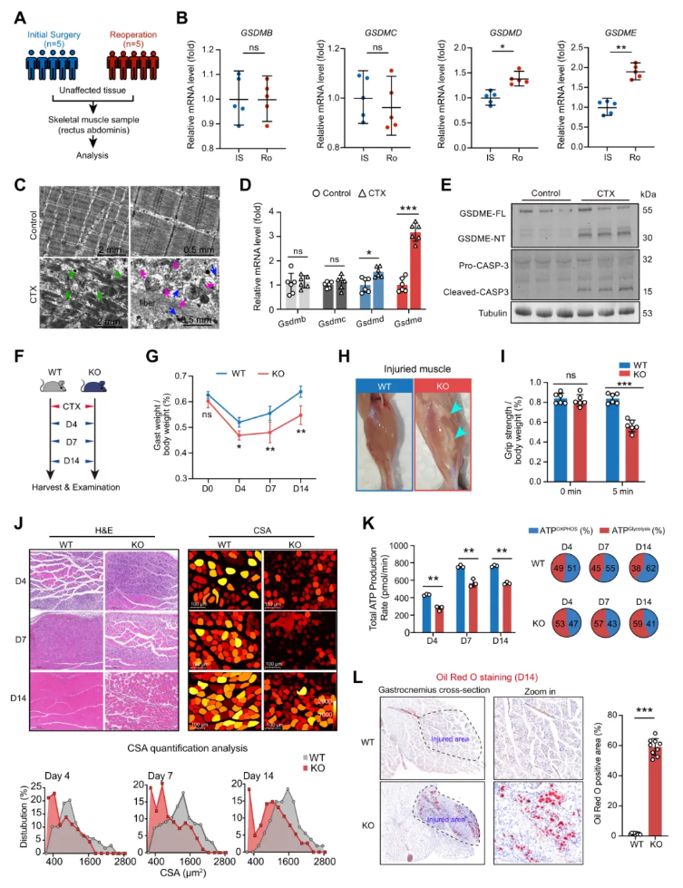 JCI(IF 13.6)|焦亡不只是“损伤”，海军军医大学研究团队解锁肌肉再生密码—GSDME/IL-18轴的神奇作用(图3)