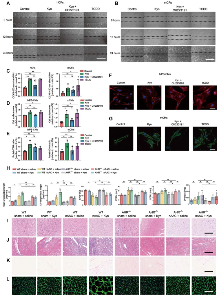 Sci.Adv.(IF=12.5)|上海交大研究团队：破解儿童心脏重塑难题，肠道菌群代谢物与益生菌干预成关键(图4)