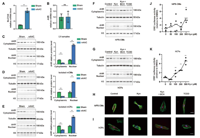 Sci.Adv.(IF=12.5)|上海交大研究团队：破解儿童心脏重塑难题，肠道菌群代谢物与益生菌干预成关键(图3)