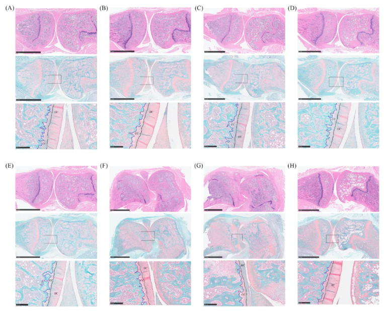 Front.Immunol.(IF=5.9)|益生菌BD400重塑肠道菌群并调控组氨酸代谢，实现类风湿关节炎早期保护(图4)